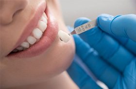 Dentist using shade guide as part of dental crown process