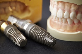 Close-up of dentures sitting next to two dental implants