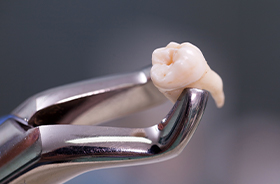 Clasp holding extracted tooth