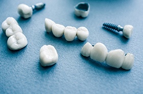 dental implants in Woodbridge for missing one tooth and missing multiple teeth