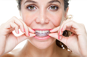 Woman placing Invisalign tray