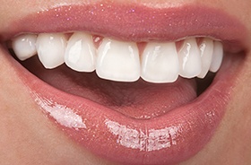 Closeup of smiling mouth