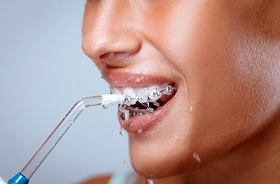 Close-up of woman using water flosser to clean around braces