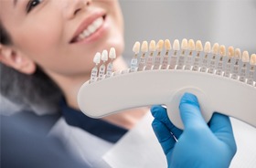 dental shade guide