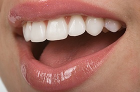 Close-up of woman’s beautiful smile with veneers in Woodbridge