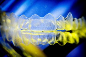 Aligner for Invisalign in Woodbridge on reflective surface