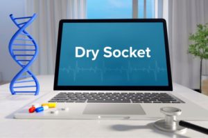 “Dry socket” wording displayed on laptop screen