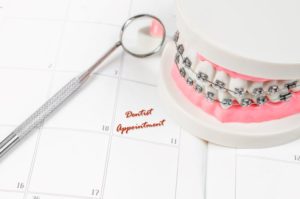 Tooth model with braces sitting on top of calendar